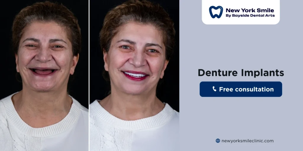 affordable denture implants